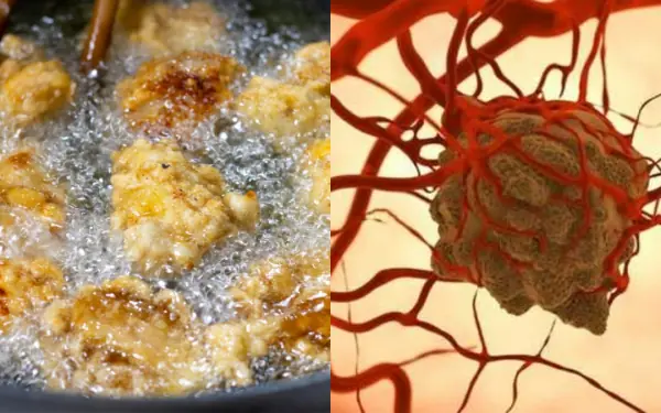 5 types of breakfast that feed cancer cells