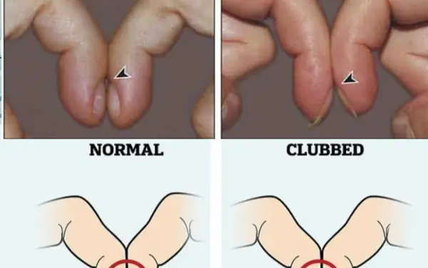 Place the tips of your index fingers close together
