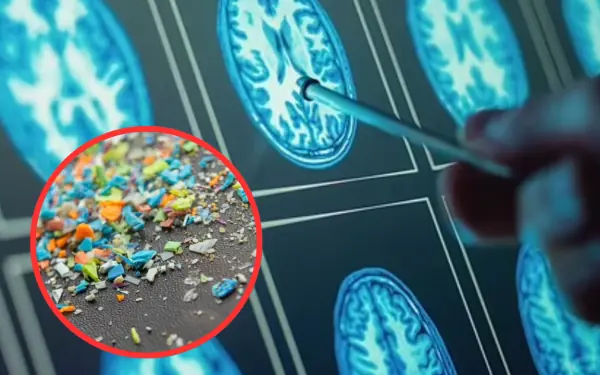 Microplastic particles are filled in the human b.r.a.i.n