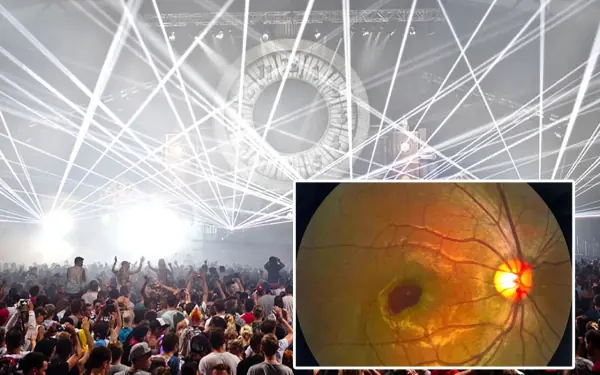 Stage Laser Lights: A Two-Second Danger That Could Cause Permanent Eye Da.mage