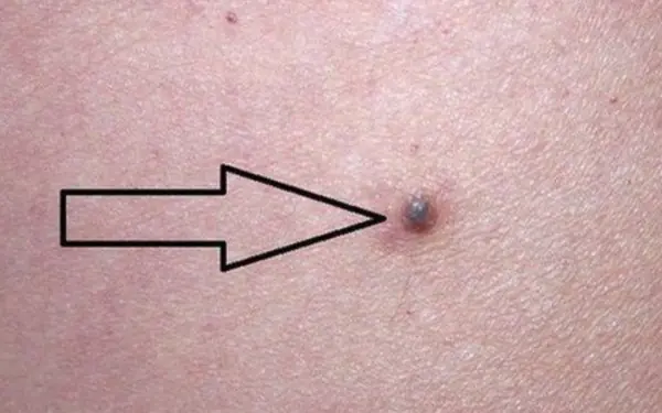 Waking up to these 7 signs may mean your body is silently feeding cancer cells.
