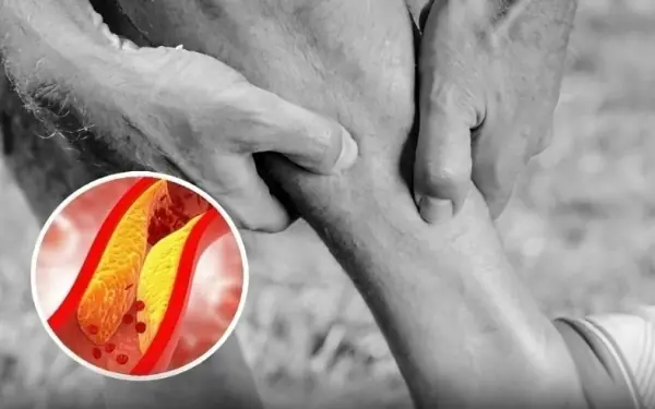 Your feet could be signaling that your arteries are clogged