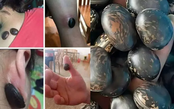 Every family should have this type of seed