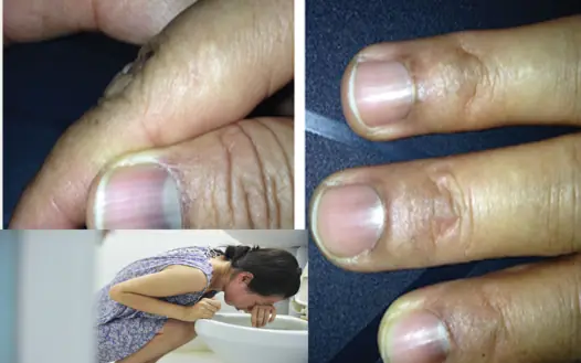 7 signs of cancer in the morning when waking up without knowing