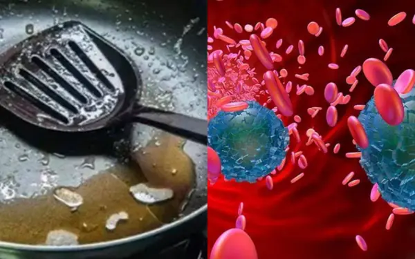 Plastic Utensils in Your Kitchen May Be Harboring Microplastics Linked to Cancer