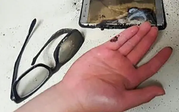 Phone battery explodes, what should you do to protect yourself