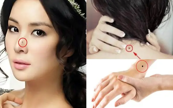 8 moles bring luck