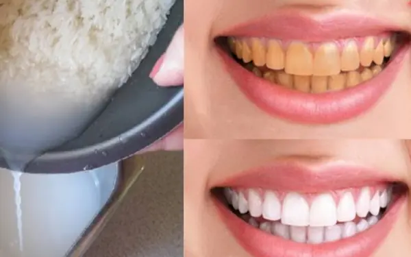 Repaying Toothpaste Don't waste money on the dentist anymore.