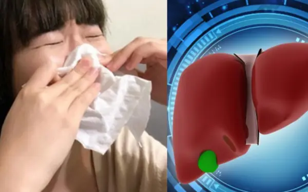 5 signs on the nose warn of diseases