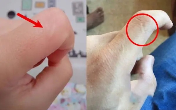 That scar means