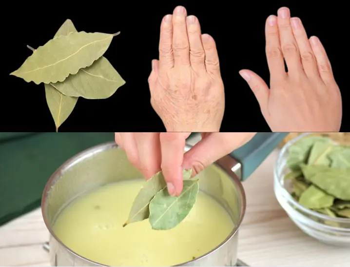 Bay leaf is 1000x more powerful than botox!