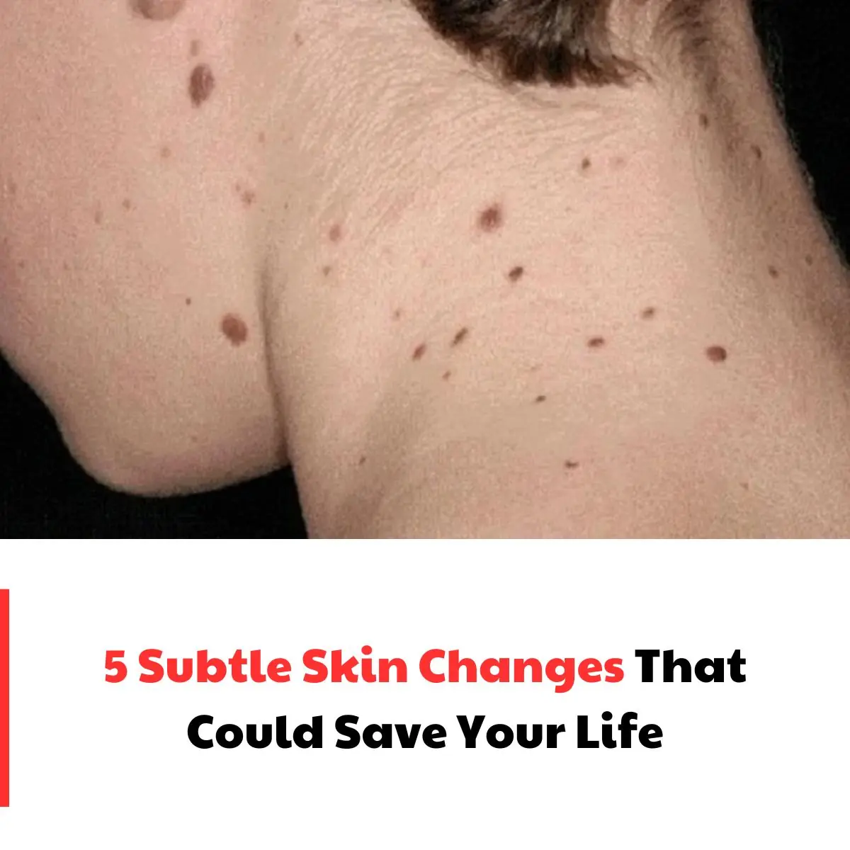 5 Subtle Skin Changes That Could Save Your Life