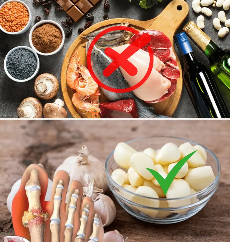 Best Foods for Gout: What to Eat to Manage Your Symptoms