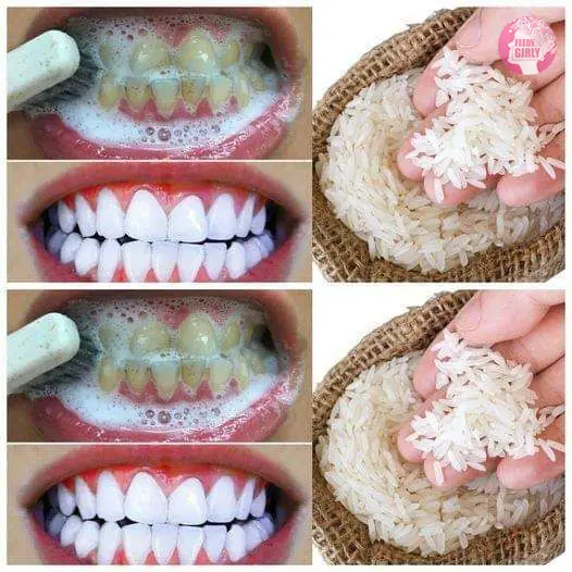 Whiten Teeth with Rice and Brighten Your Smile Naturally
