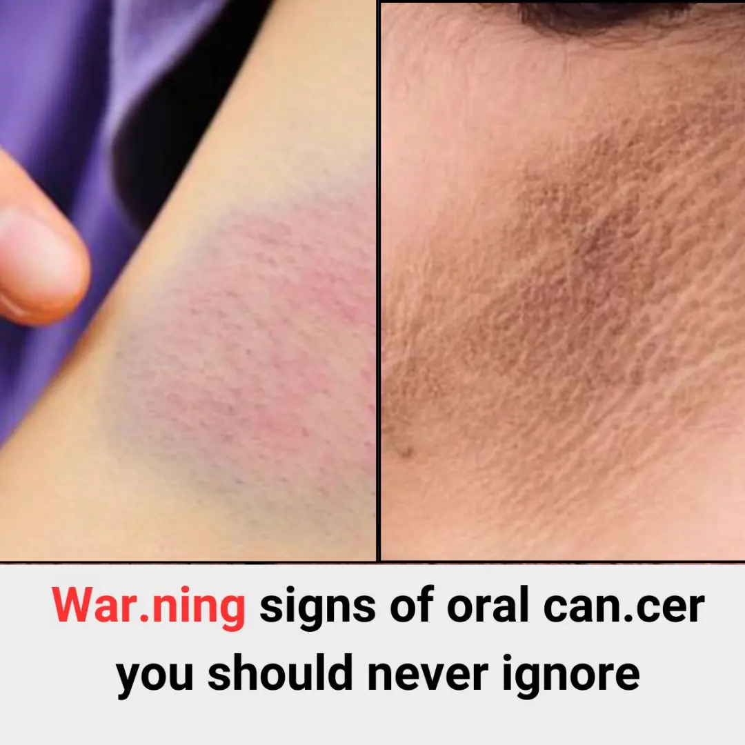 4 war.ning signs 👉