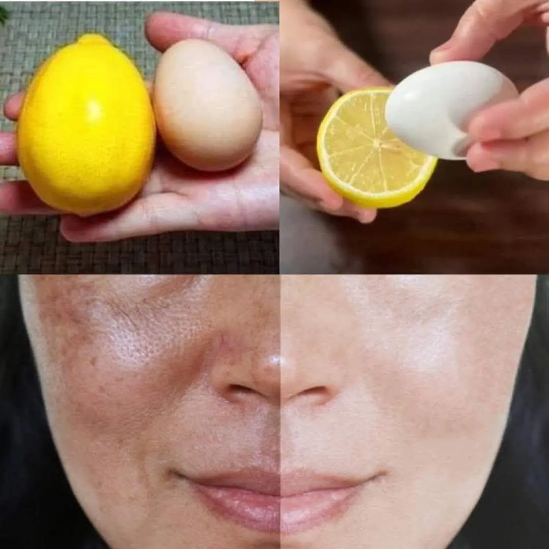 Few Know This Secret Recipe 1 Lemon and 1 Egg