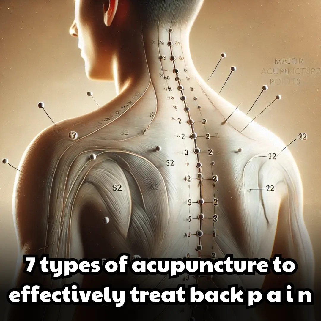 7 types of acupuncture to effectively treat back p a i n