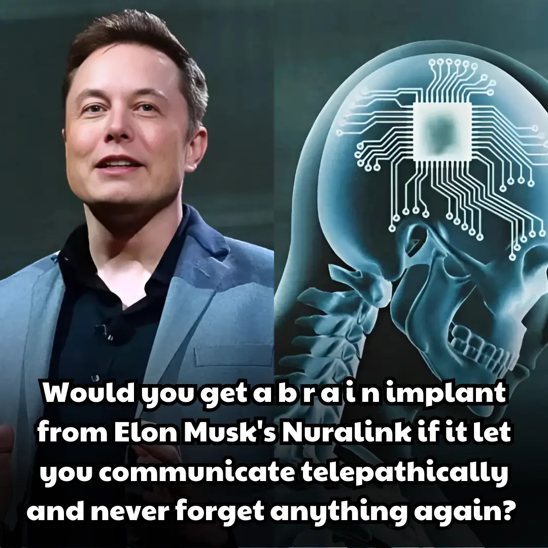 Would you get a brain implant from Elon Musk's company?