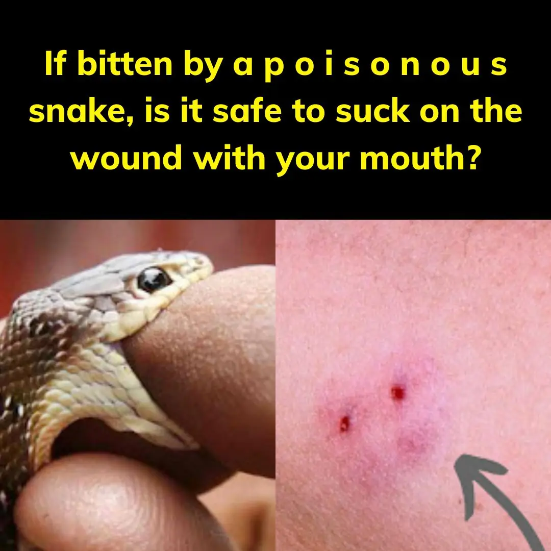 If bitten by a poisonous snake, is it safe to suck on the wound with your mouth?