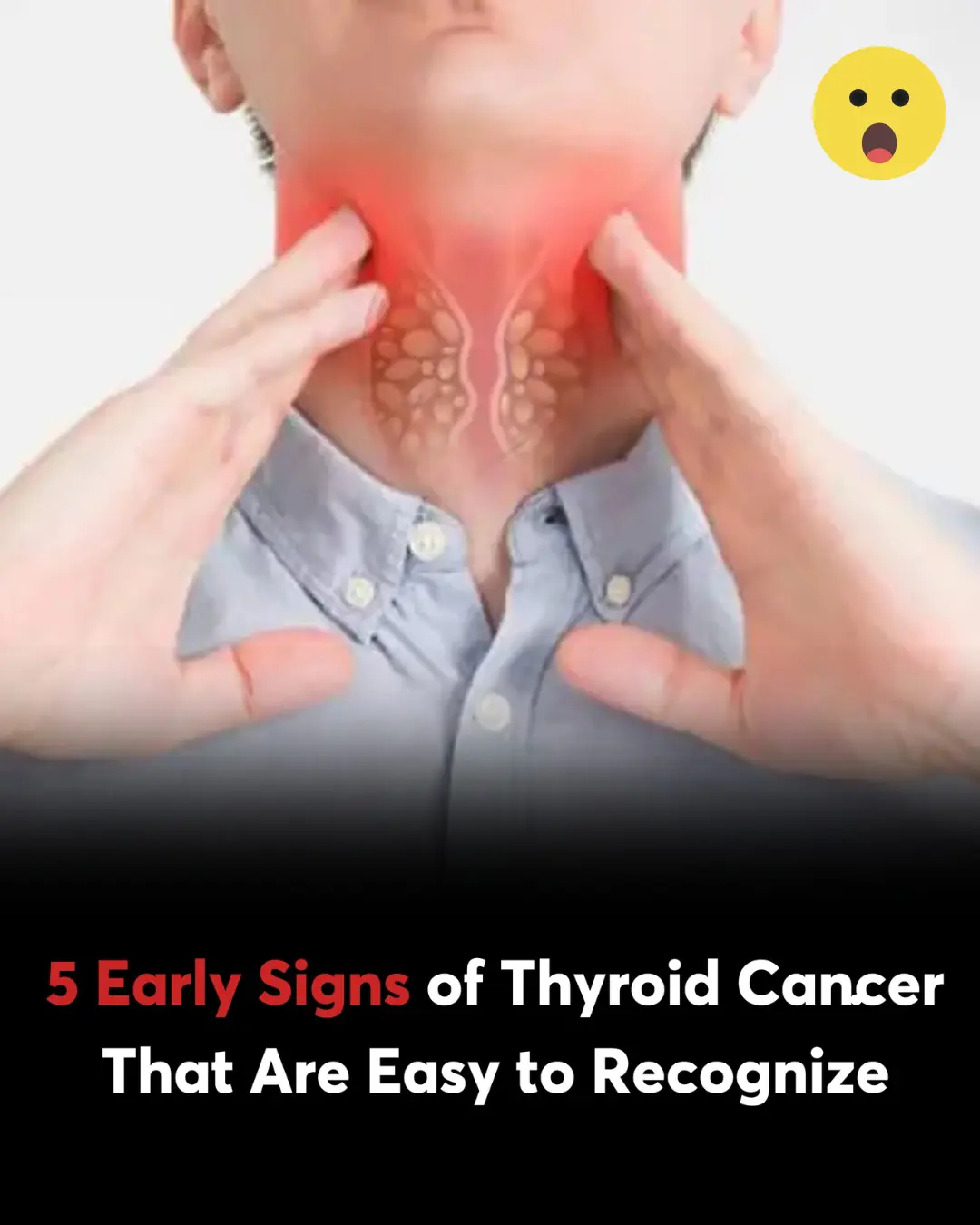 5 Early Signs of Thyroid Cancer That Are Easy to Recognize