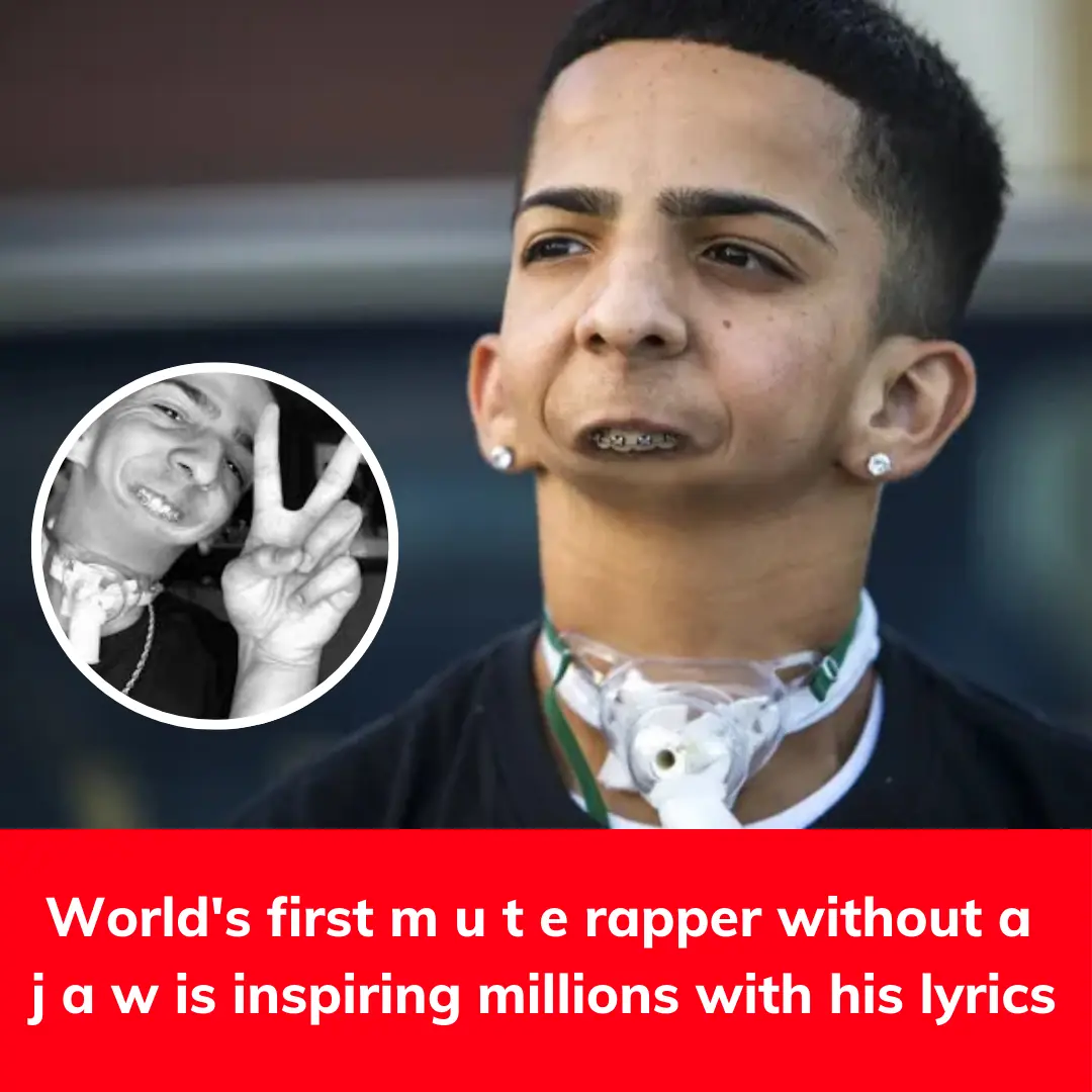 World's first m u t e rapper without a  j a w is inspiring millions with his lyrics