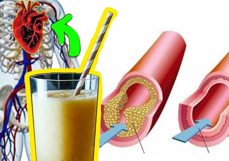 Clear Your Arteries with This Simple Juice