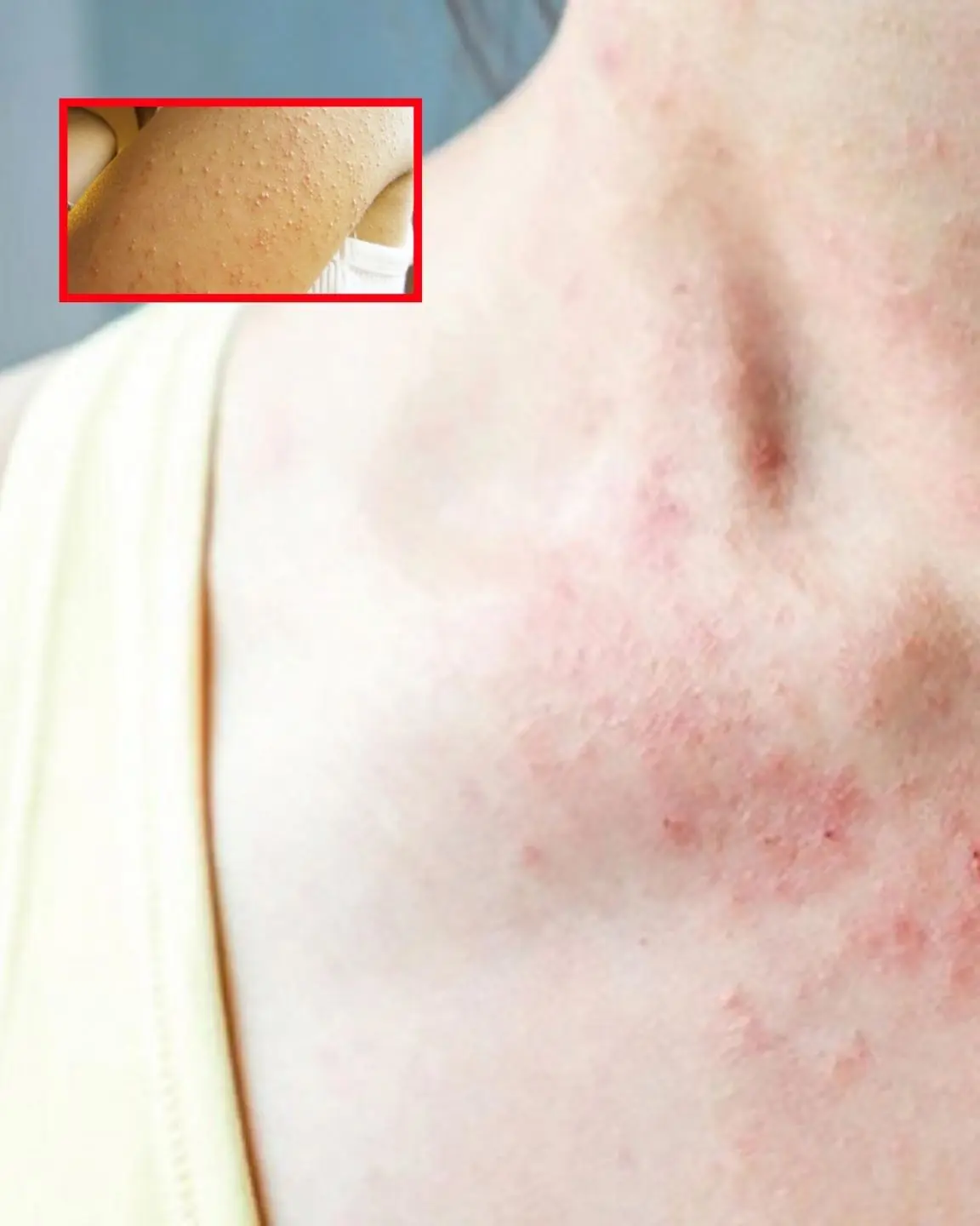 Bumpy skin without itching - do not ignore it because this is a sign of 8 dermatological diseases