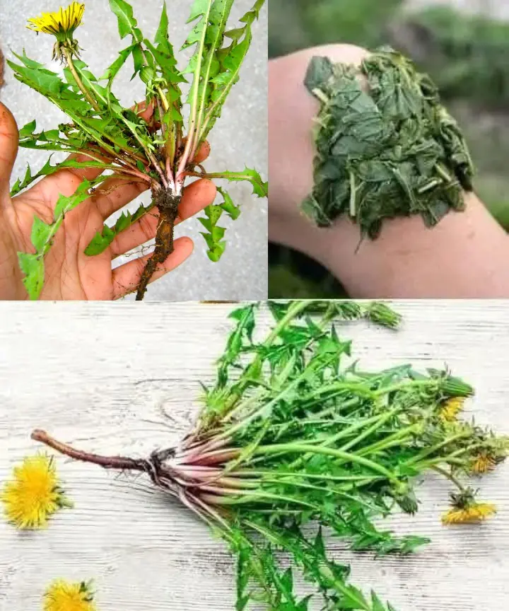 20 Reasons to Gather Dandelion Blooms Until Your Fingers Turn Yellow