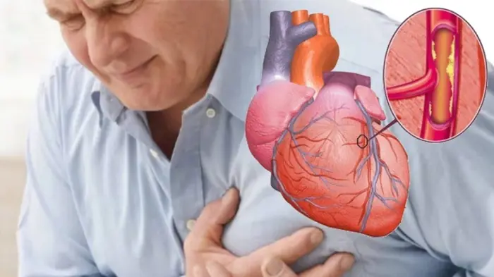 Early Warning Signs of a Heart Att.ack One Month in Advance