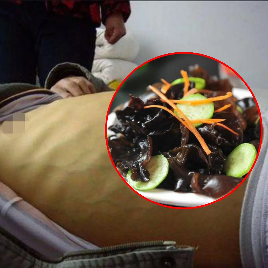 33-year-old m a n with te.rm.inal l.i.ver c.a.ncer, doctor points out 4 types of food that are harmful to the l.i.ver