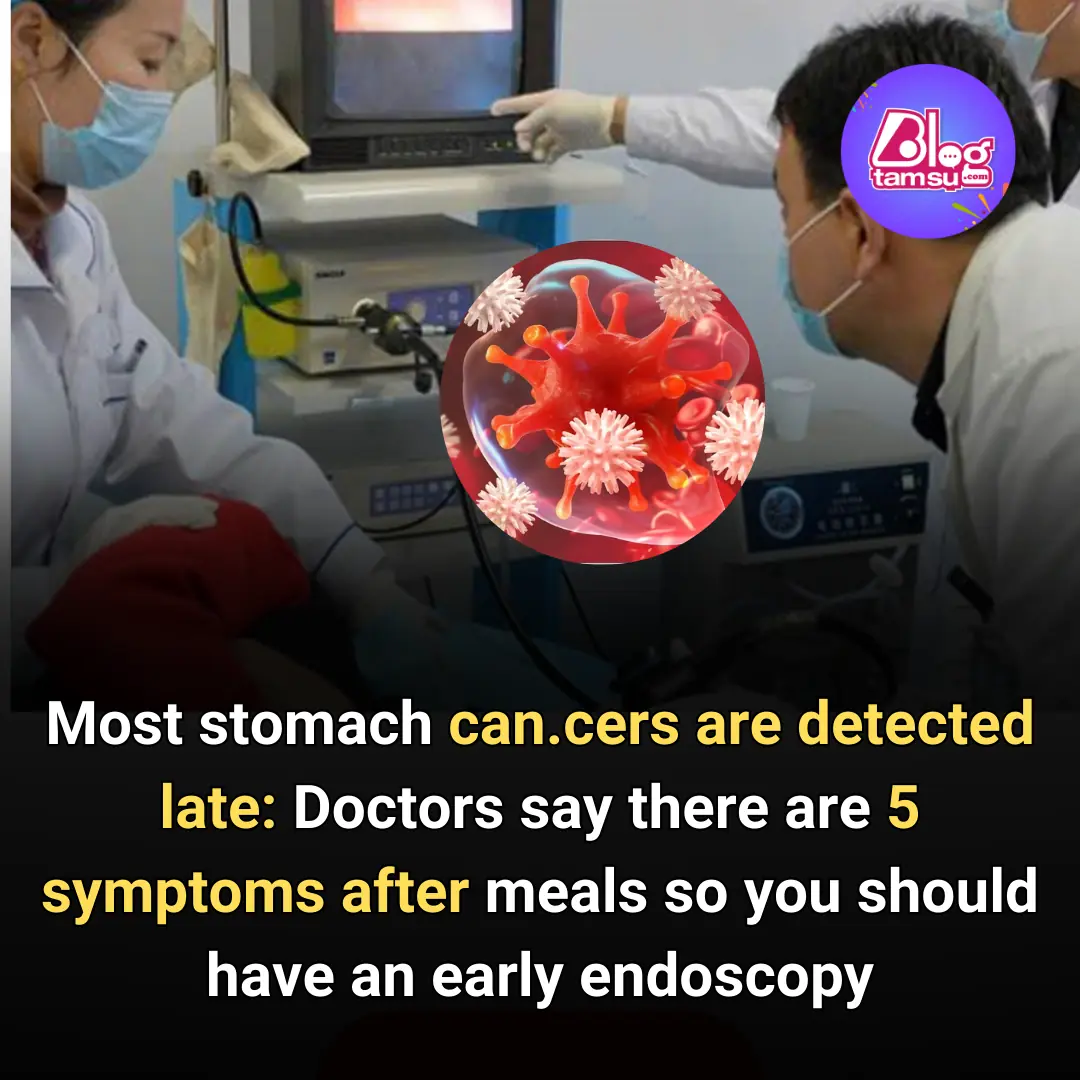 Doctors say there are 5 symptoms after meals so you should have an early endoscopy