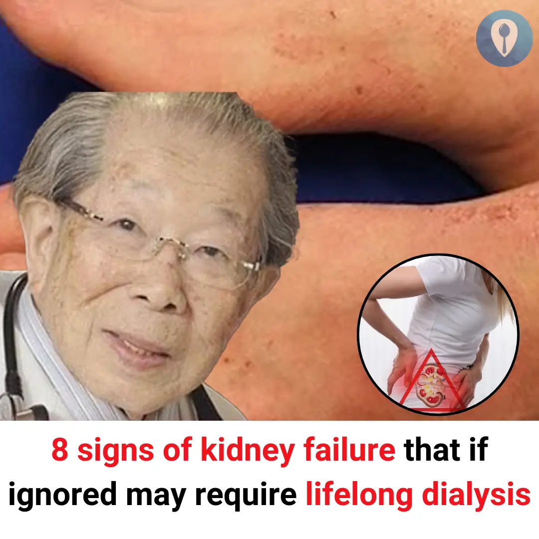 8 signs of kidney failure that if ignored may require lifelong dialysis