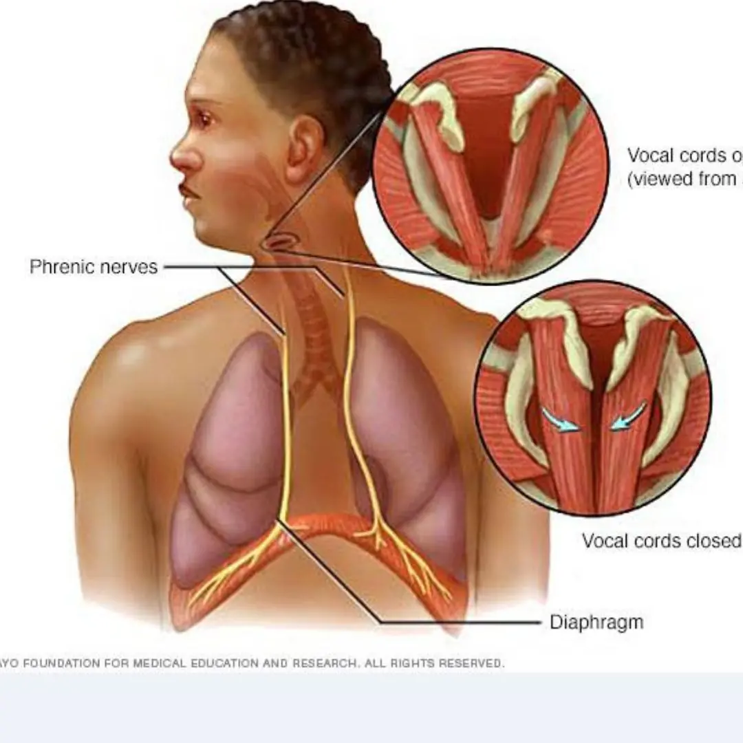 Hiccups - 6 ways to get rid of hiccups quickly that you may not know