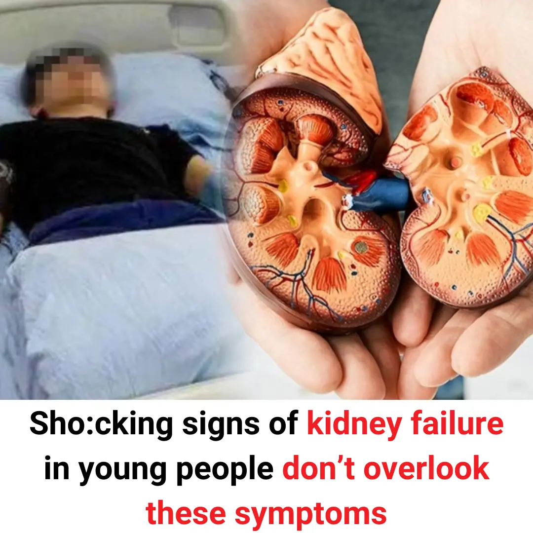 6 warning signs of kidney failure young people must not ignore