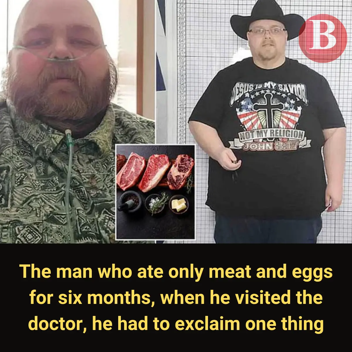 The Man Who Ate Only Meat and Eggs for Six Months: When He Visited the Doctor, He Had to Exclaim One Thing