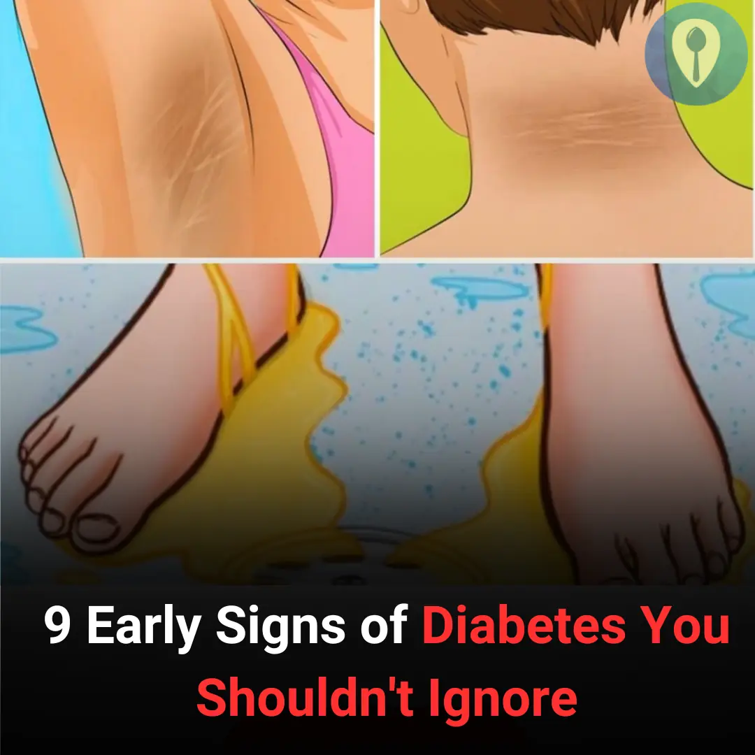 9 Early Signs of Diabetes You Shouldn't Ignore