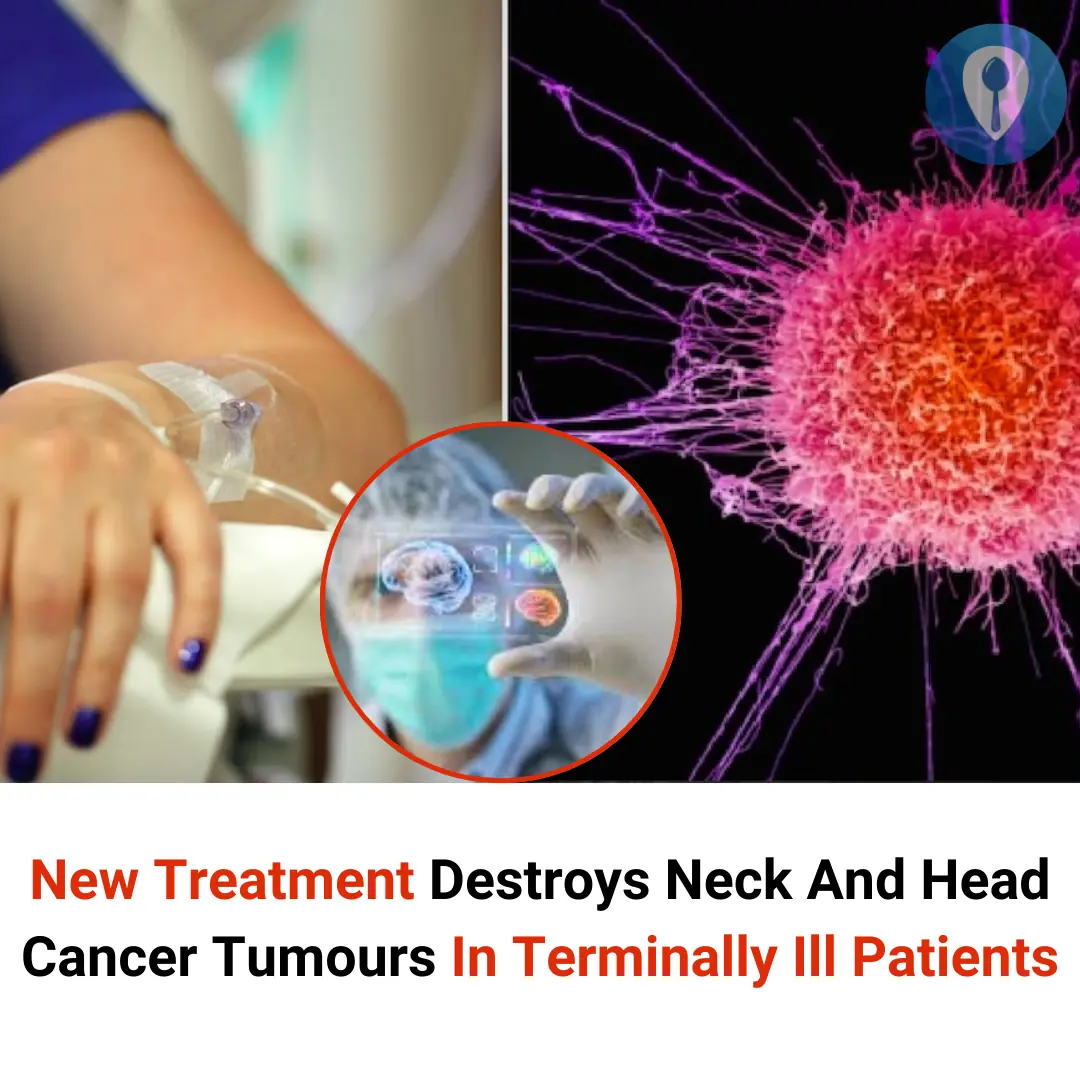 New Treatment Destroys Neck And Head Cancer Tumours In Terminally Ill Patients