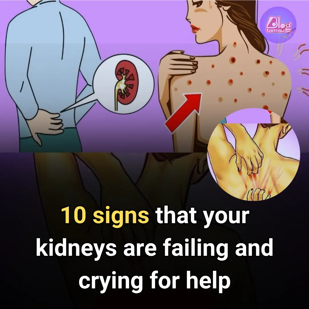 If Your Kidneys Are in Danger, the Body Will Show these 10 Signs