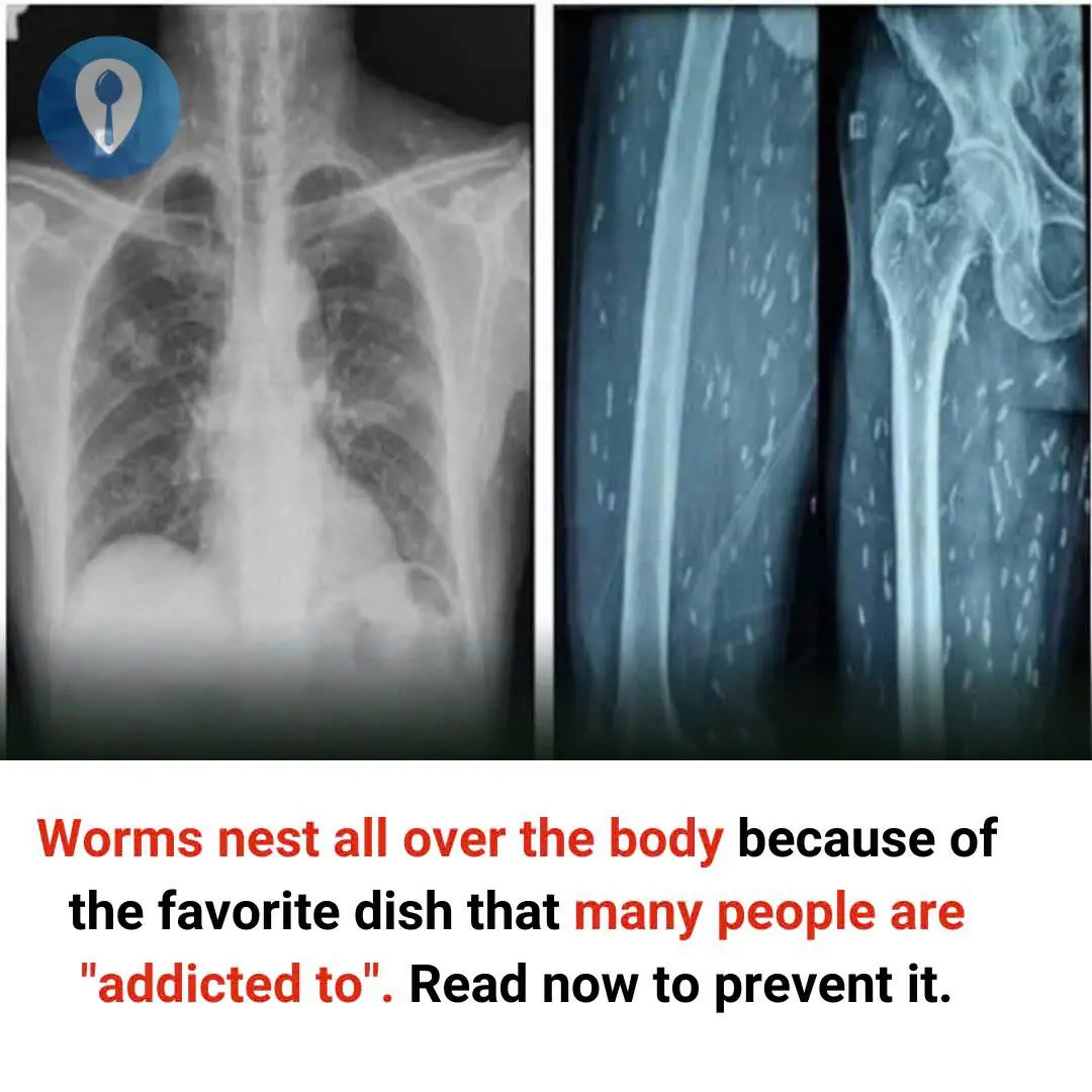 Worms nest all over the body