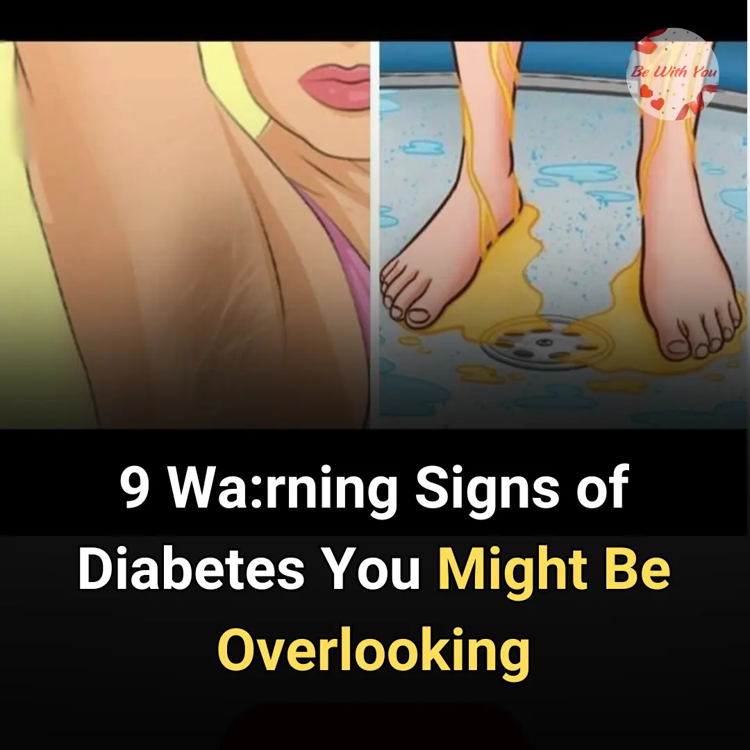 9 Wa:rning Signs of Diabetes You Might Be Overlooking