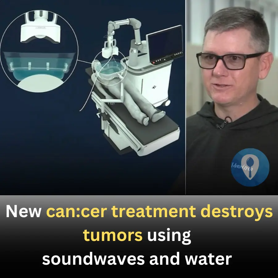 New can:cer treatment destroys tumors using soundwaves and water