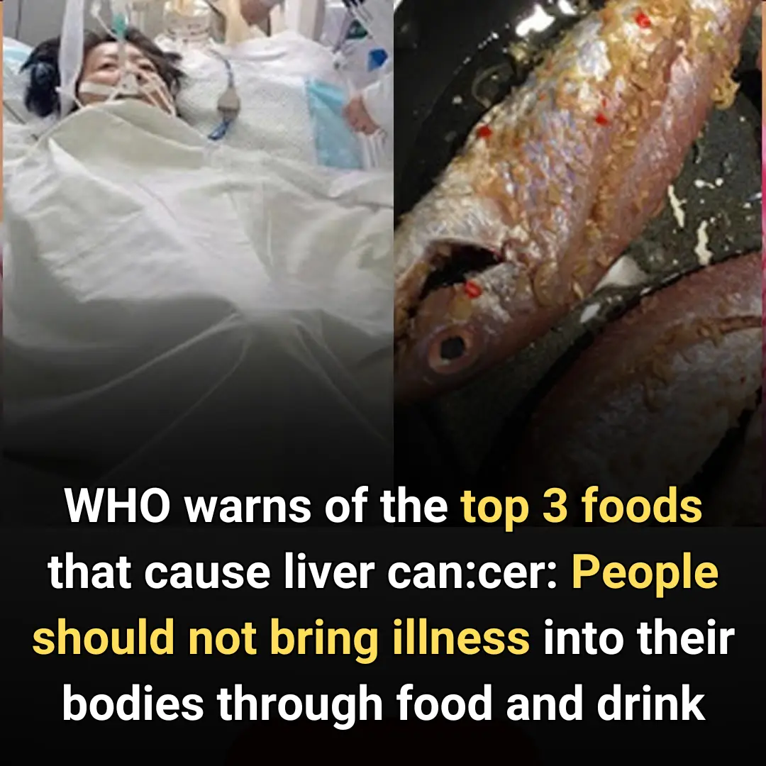 WHO warns of the top 3 foods that cause liver c.a.n.c.e.r