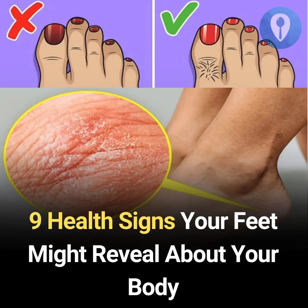 Feet Can Reveal Heart Problems