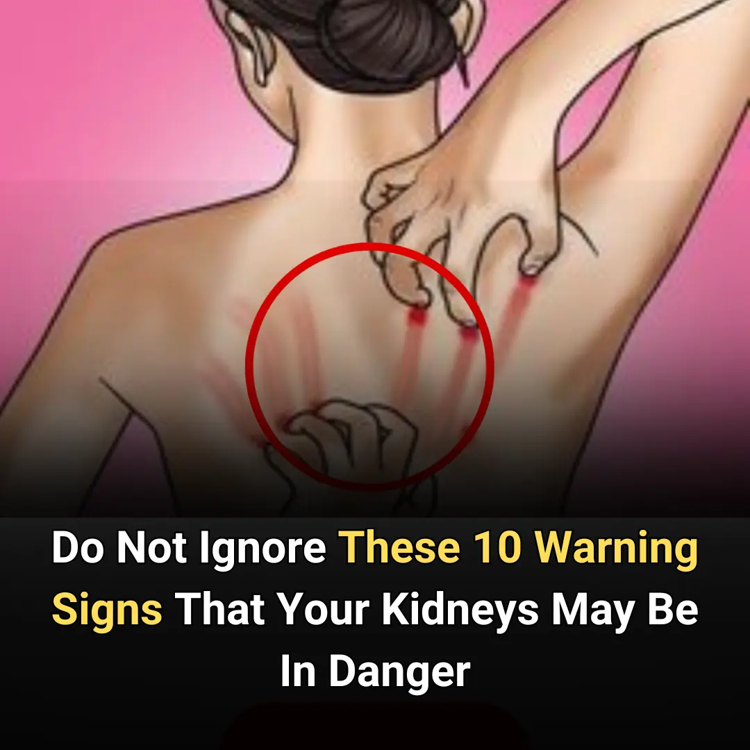 Do Not Ignore These 10 Warning Signs That Your Kidneys May Be In Danger