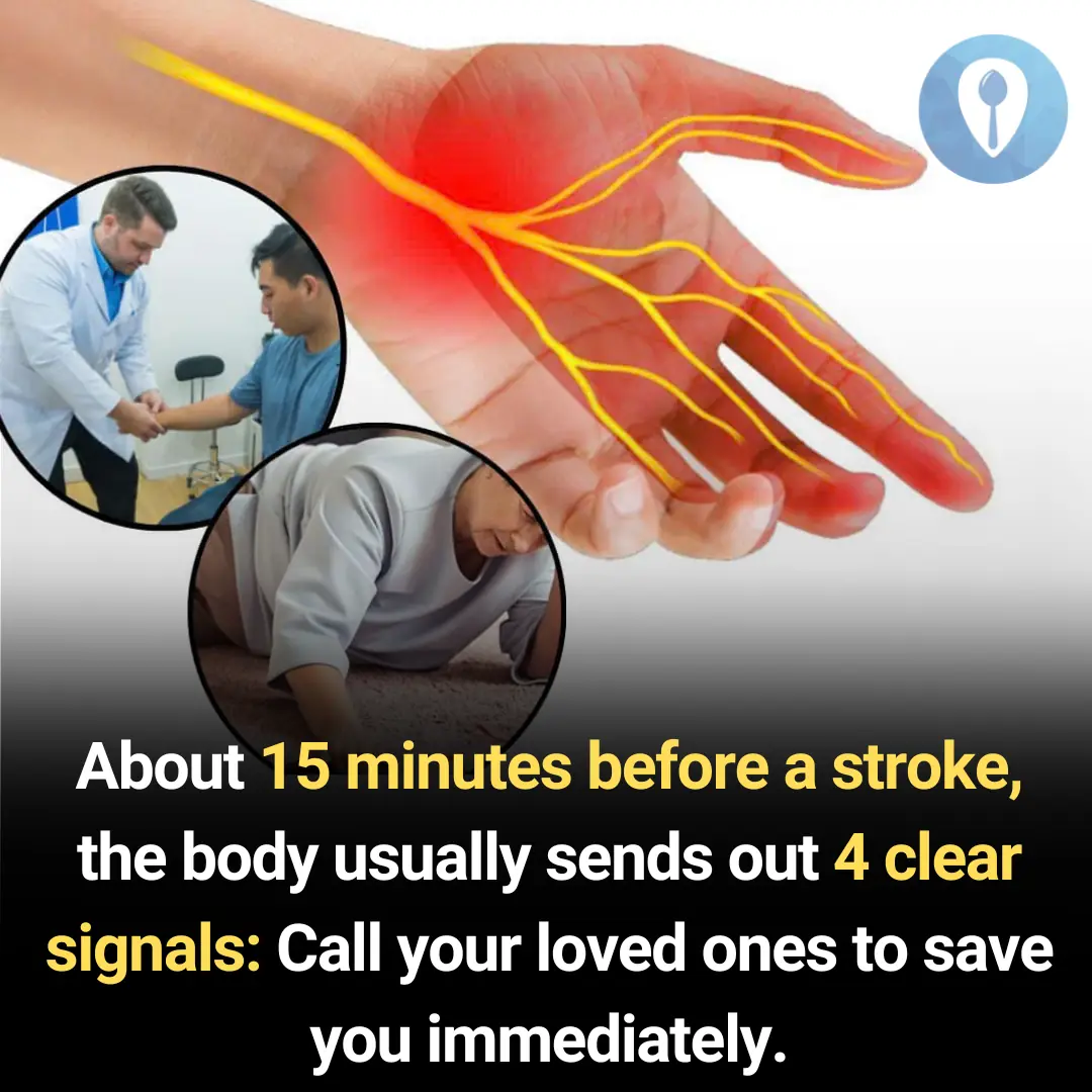 4 Early Warning Signs of a Stroke That Occur 15 Minutes Before It Happens