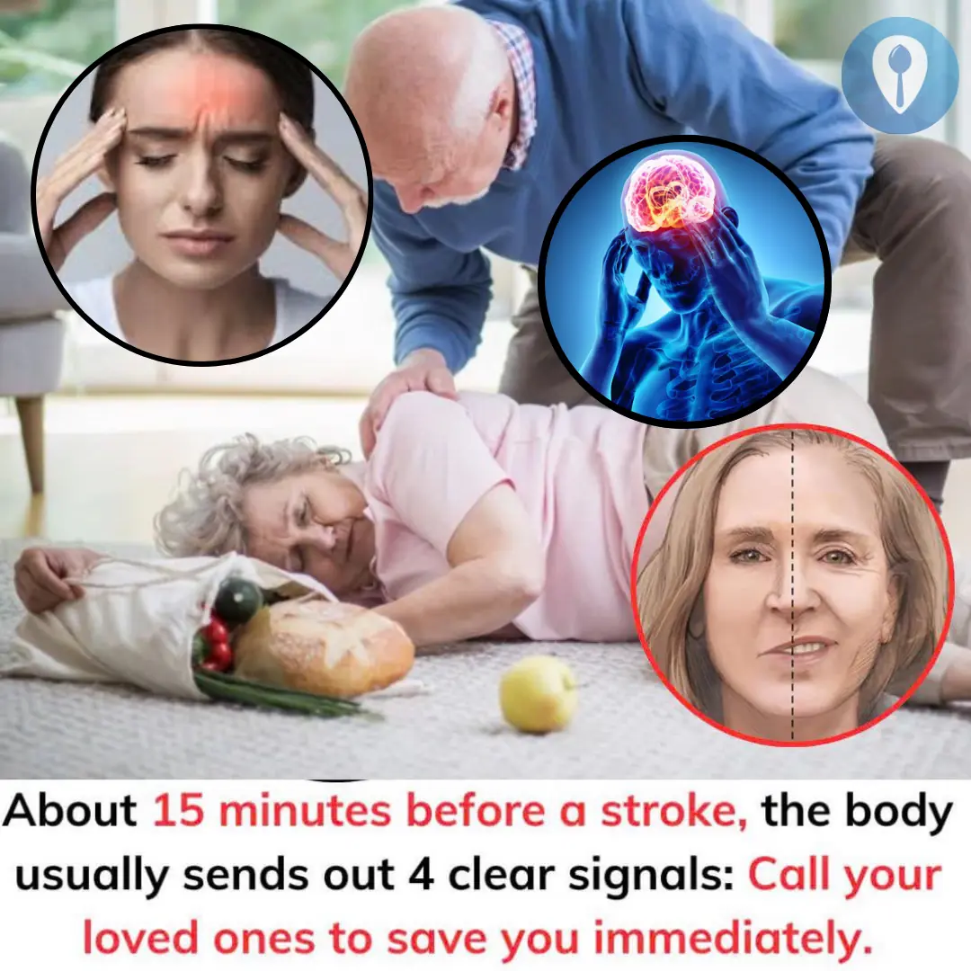 About 15 minutes before a stroke, the body usually sends out 4 clear signals