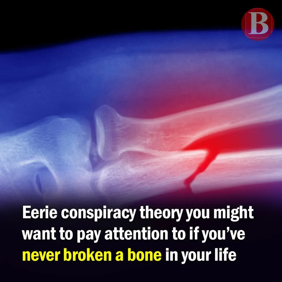 If You’ve Never Broken a Bone There’s a Strange Conspiracy Theory You May Want to Pay Attention To