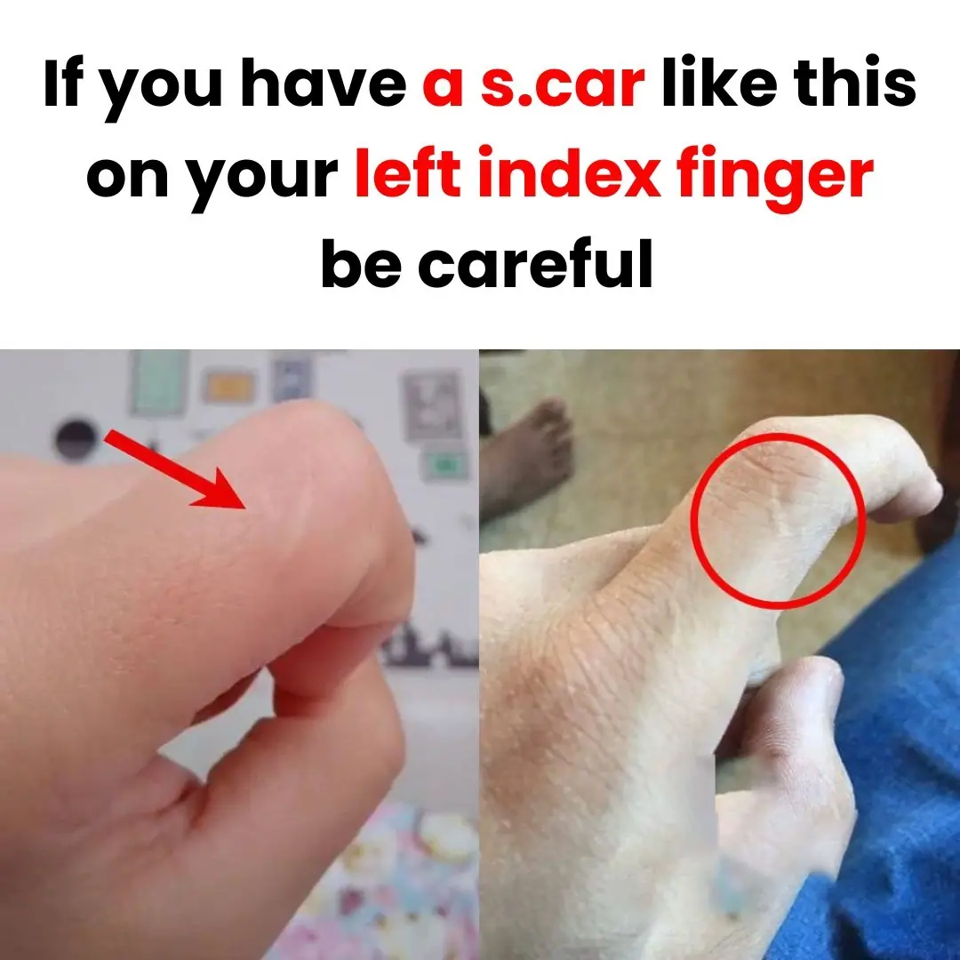 Anyone with this scar should be careful...