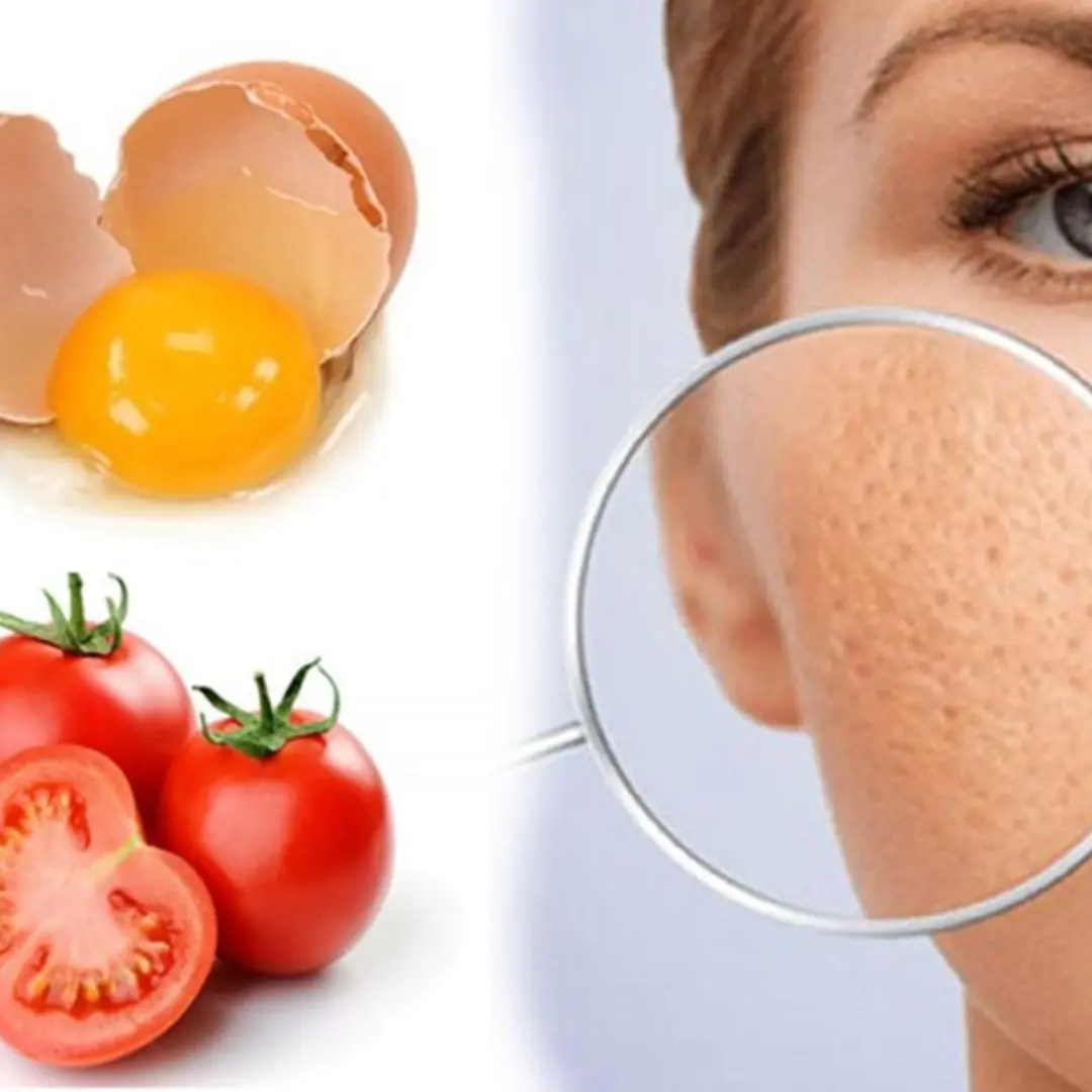 Ways to tighten pores naturally, simply and effectively