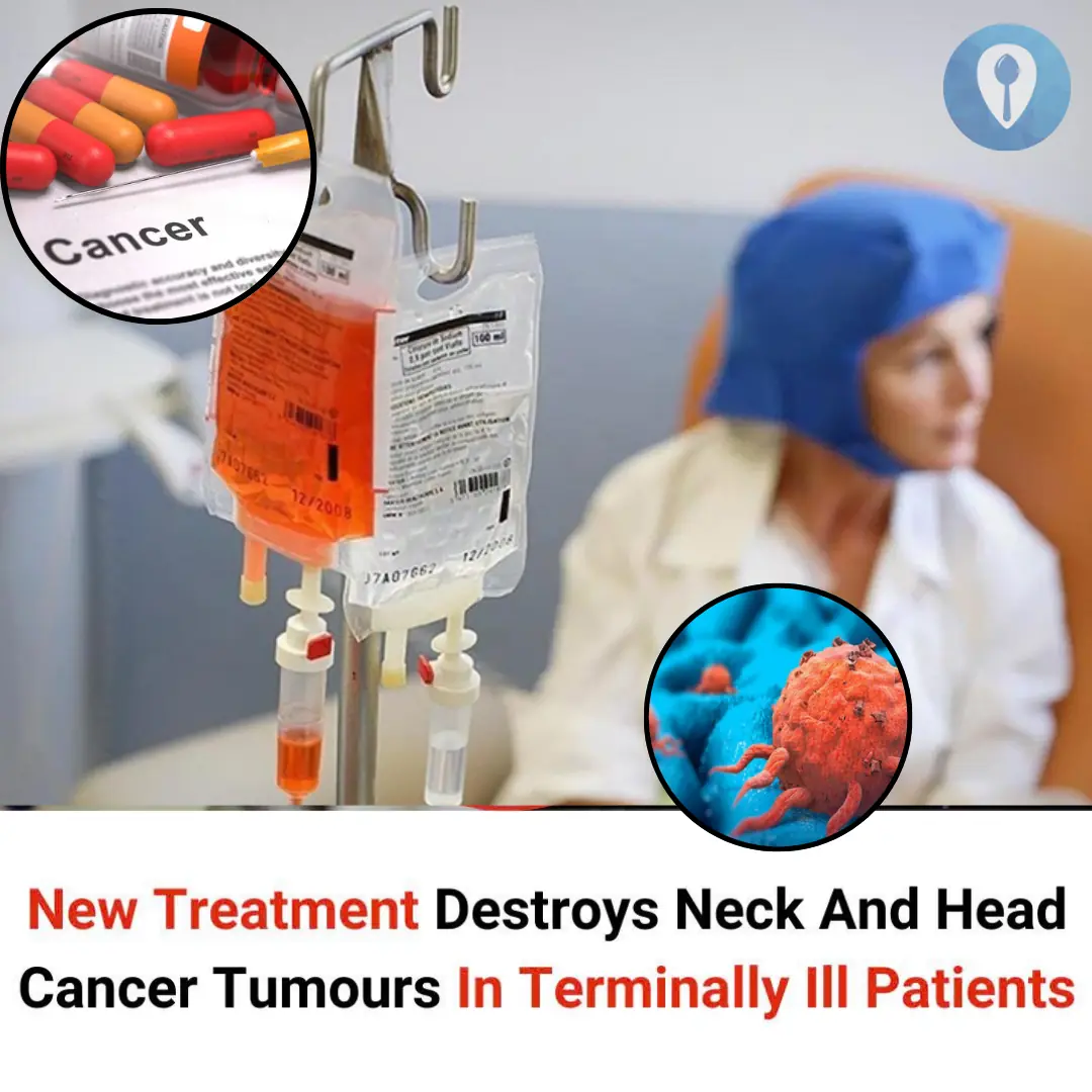 New Treatment Destroys Neck And Head Can.cer Tumours In Terminally Ill Patients